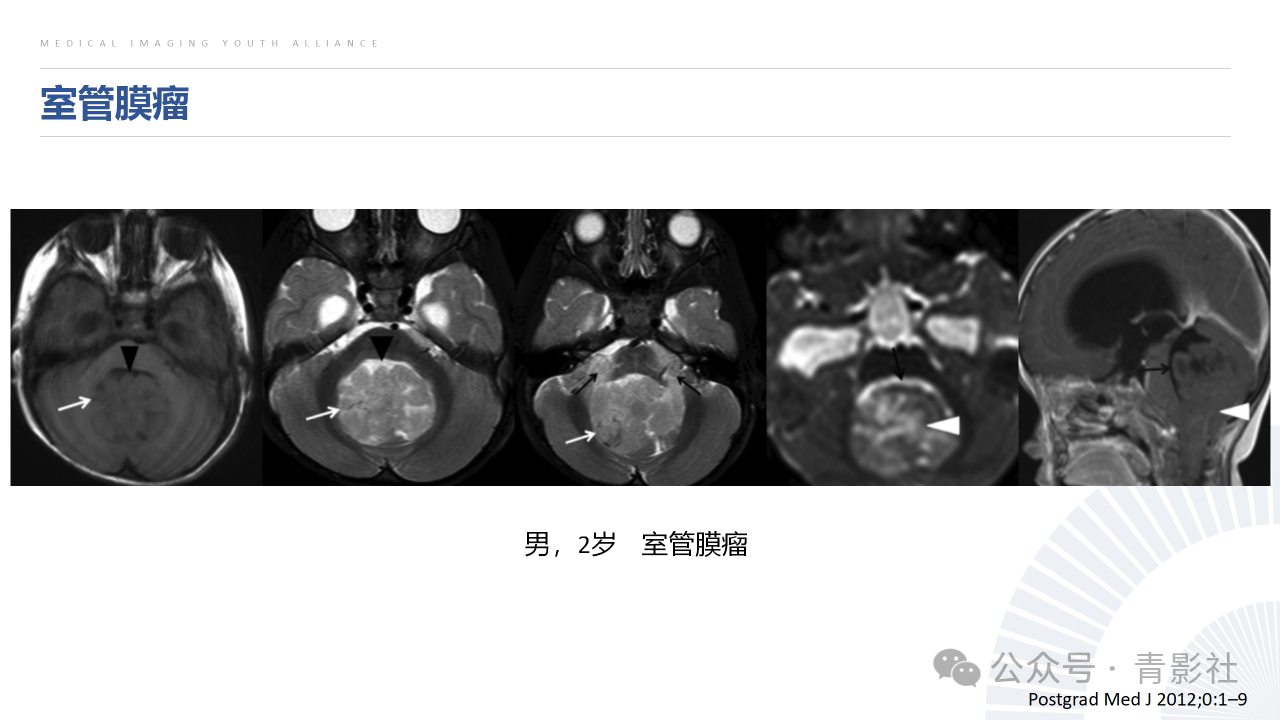 1fa27c2273afe38c5cb7d521f3e17ded.png