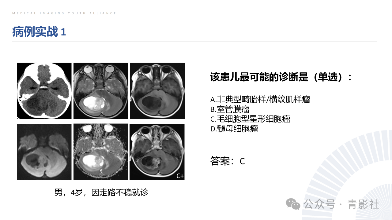 ee9e790dbc9c3ed120c5ace0376b3b8a.png