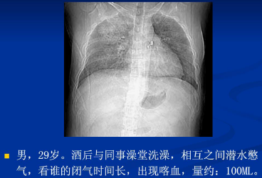 cc8ff1d1872a40f621092affcf859f95.png