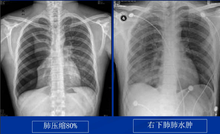 a3b1074d09f141fe7ea7d803d8fde8f5.png