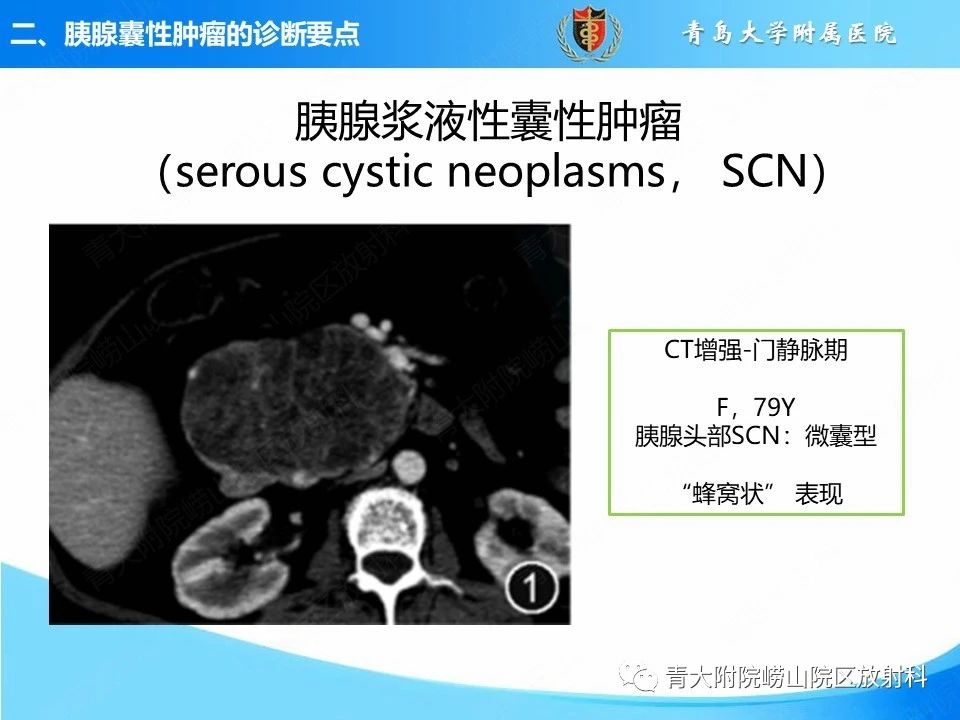 1cf45afdb0b8d858e149c1501a1eb382.jpg
