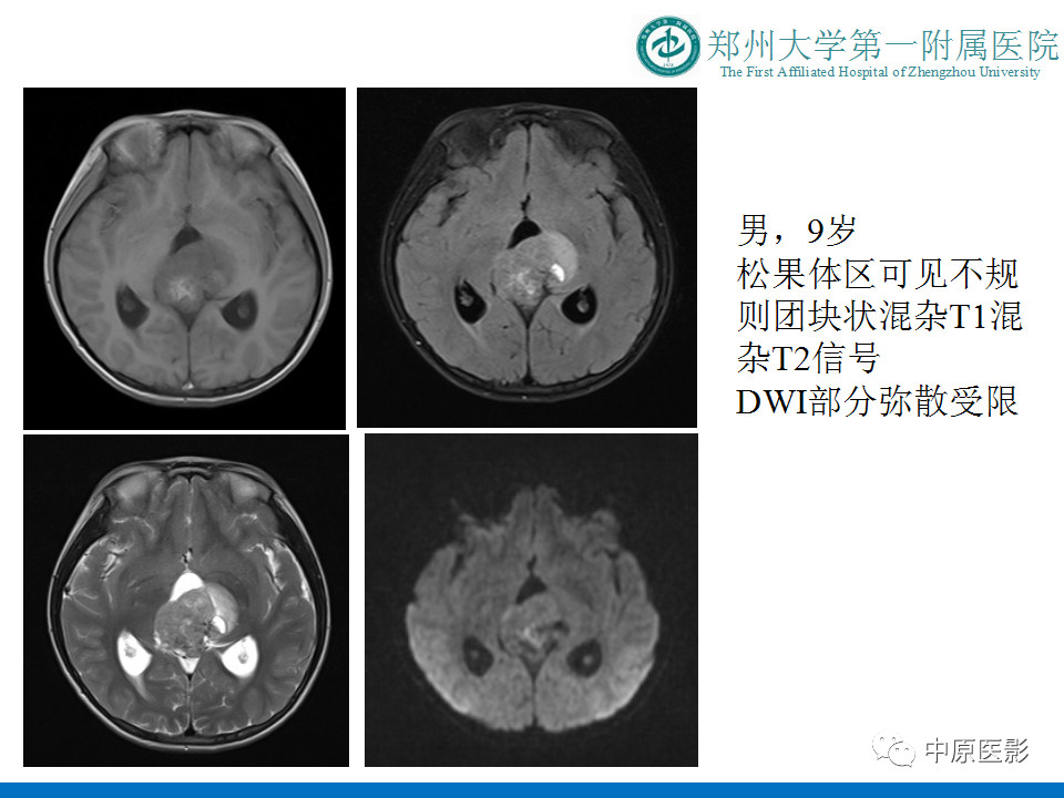 bf6b311dd9459cd923143191235a5c6b.jpg