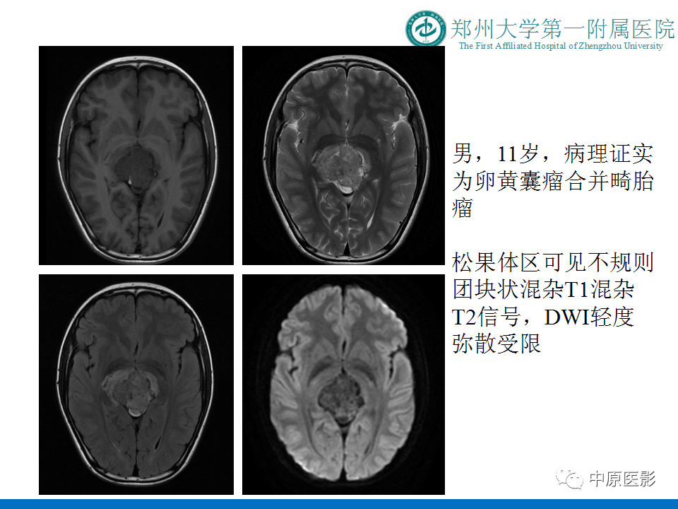 890cdf8bad2a124a4a09dc86946c6999.jpg