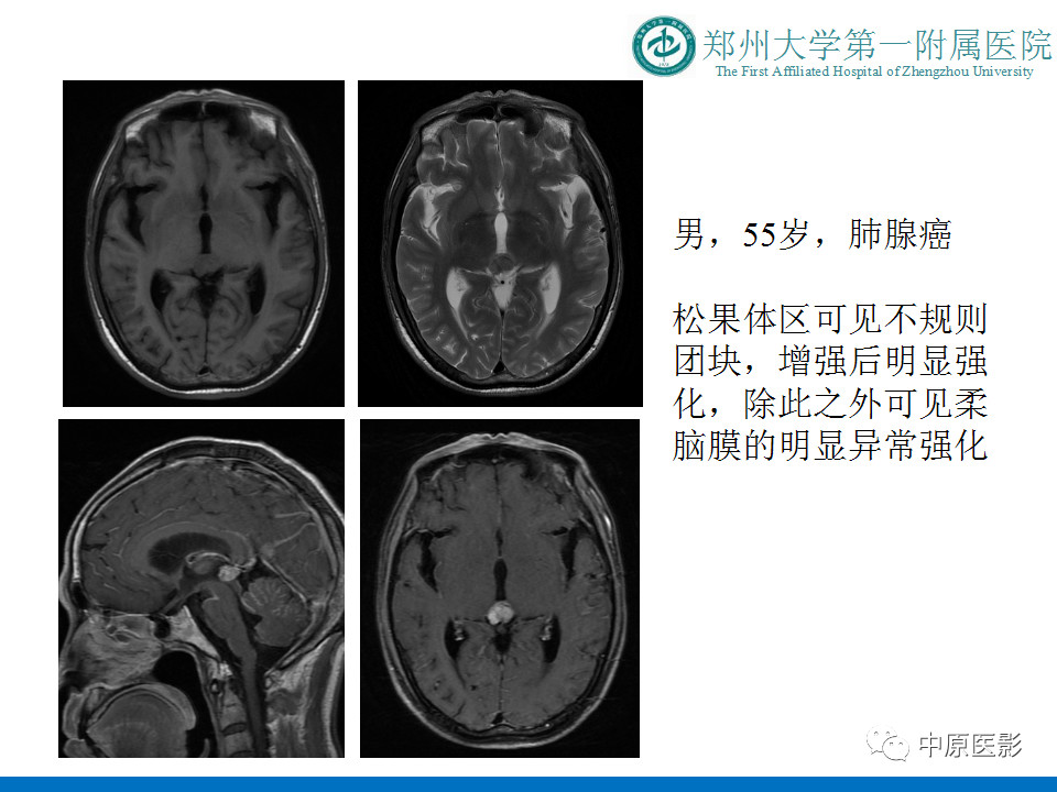 1837ec9eae4d75690b854e6b267d14d3.jpg