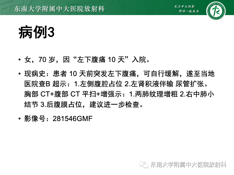 e47a51b2f28bfd47cc216c34be3142ae.png