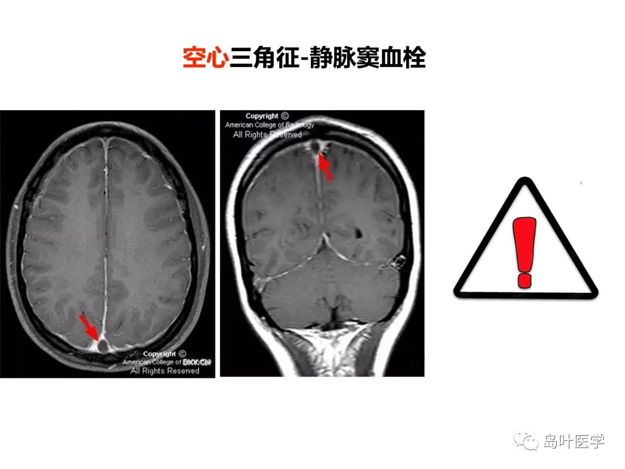 99e7c8593062af53b0f55a9893619d8c.jpg