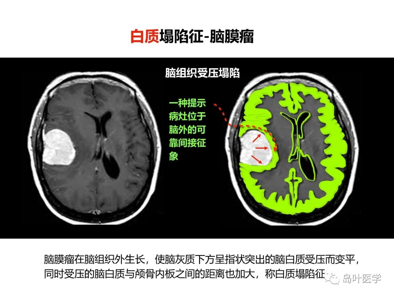 3cbe93b2afd636f20df203ac5e913525.jpg