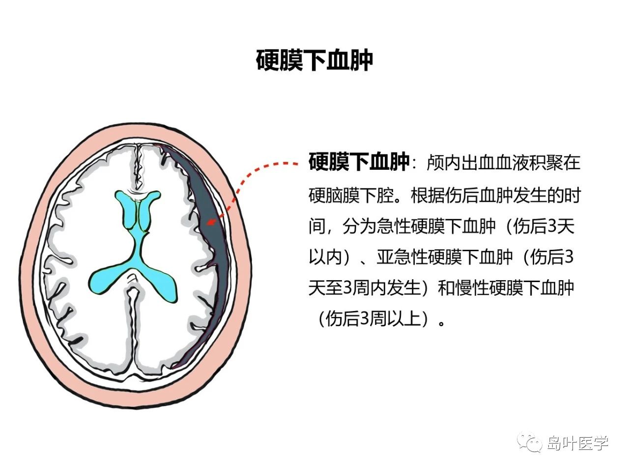 d95e8d5a892faa332e6869de0132a678.jpg