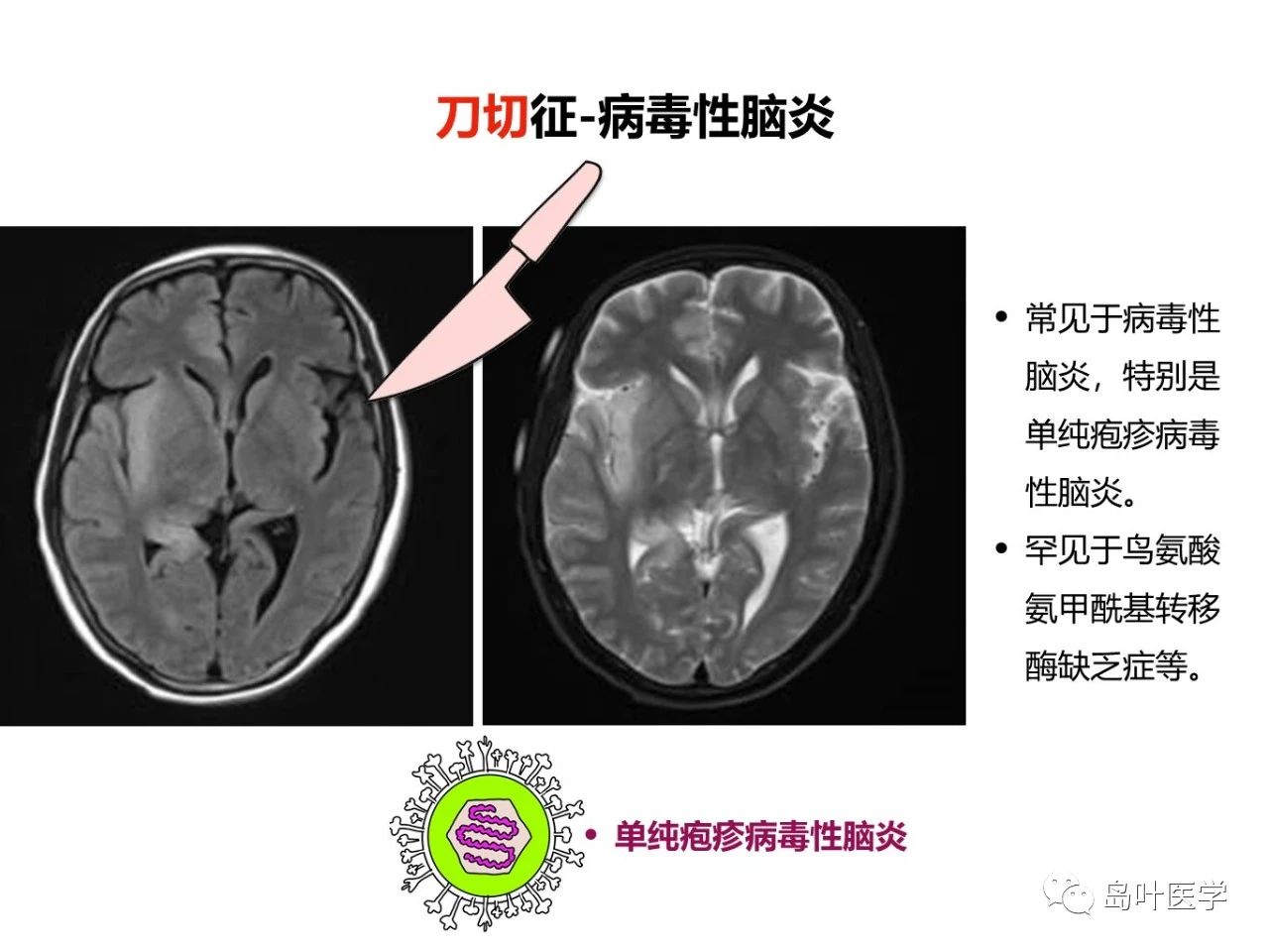 897a07c5fb4a4ab0e8baf8e5d651807c.jpg