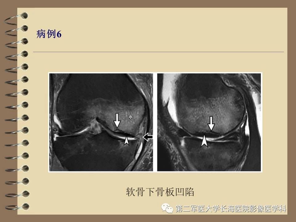 51f8d1fb7e222363ae83ac72bd02ab77.jpg
