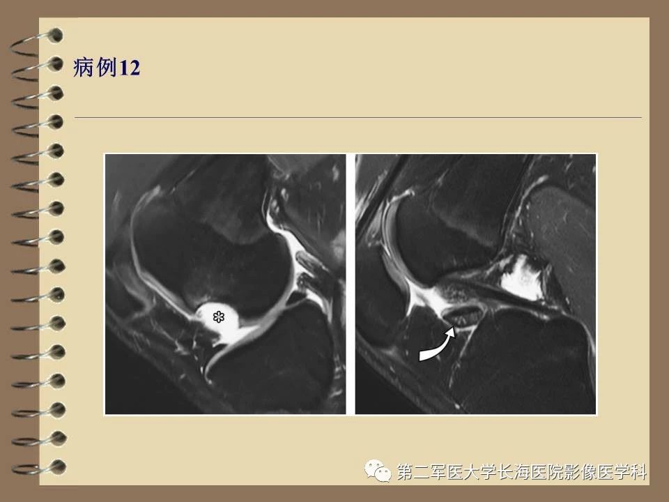 fa46a7783094099ed78fa9e2aebd4b8b.jpg