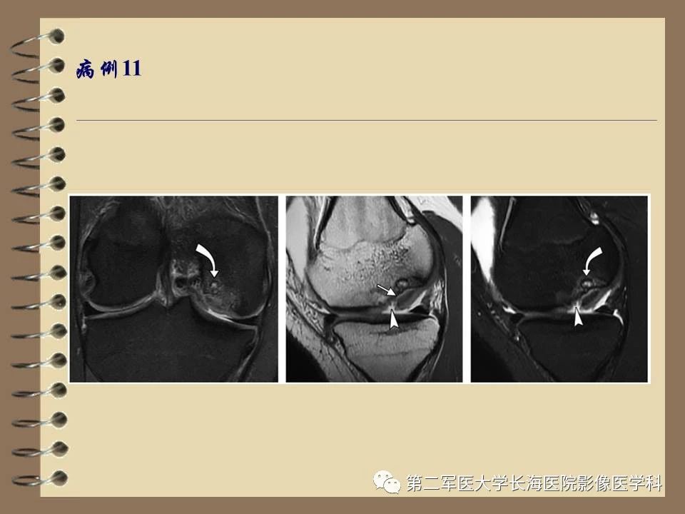 3e26bf38d385fec331ff45373cf35edc.jpg