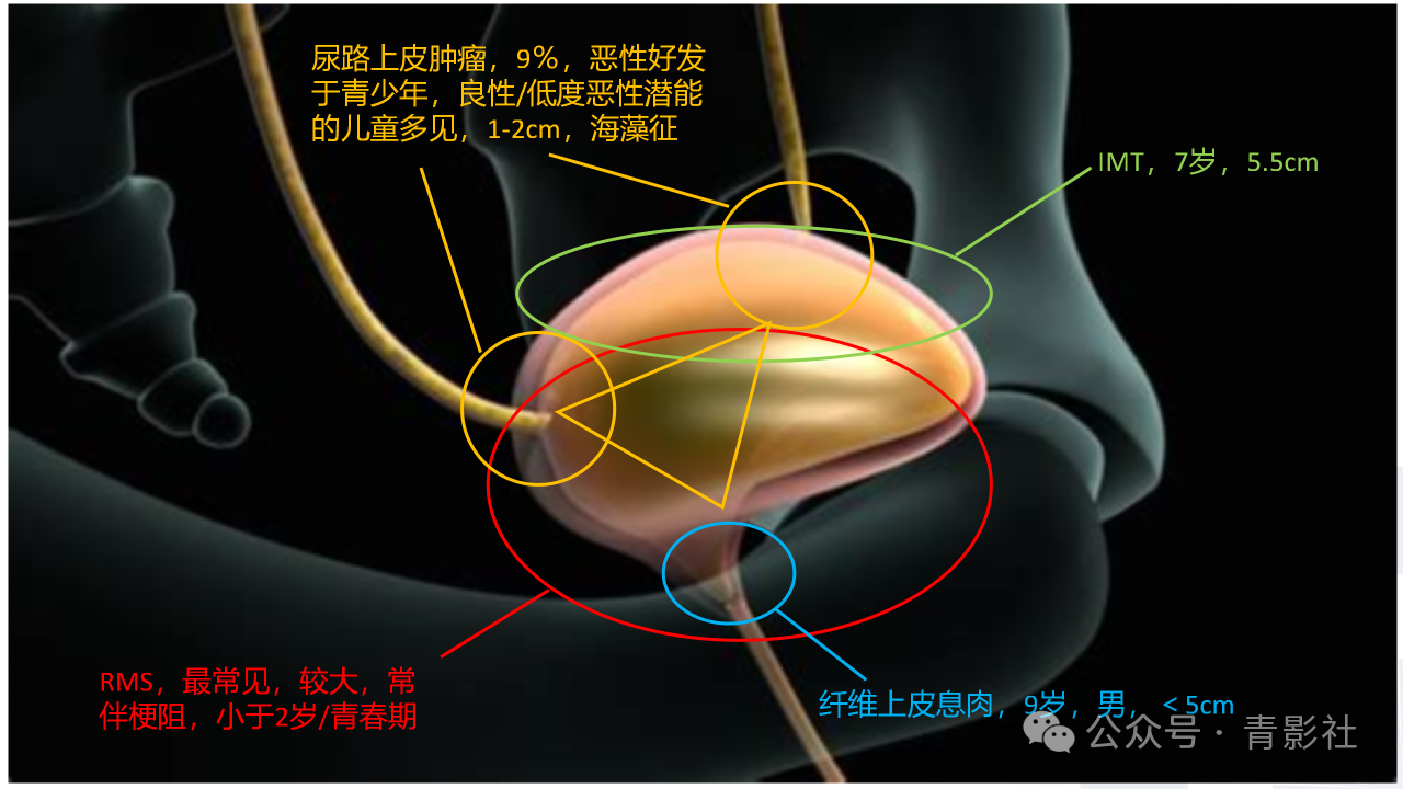 6a501fe3596fd005c88af791bb140c93.png