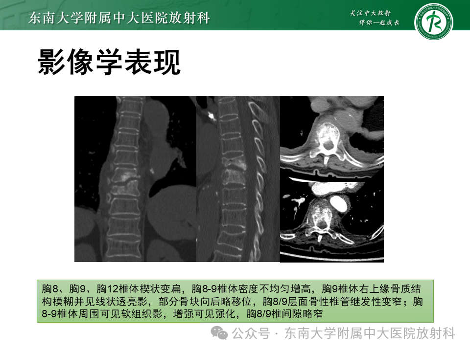 9bda862ef71305b6a94920b14d1169d7.png