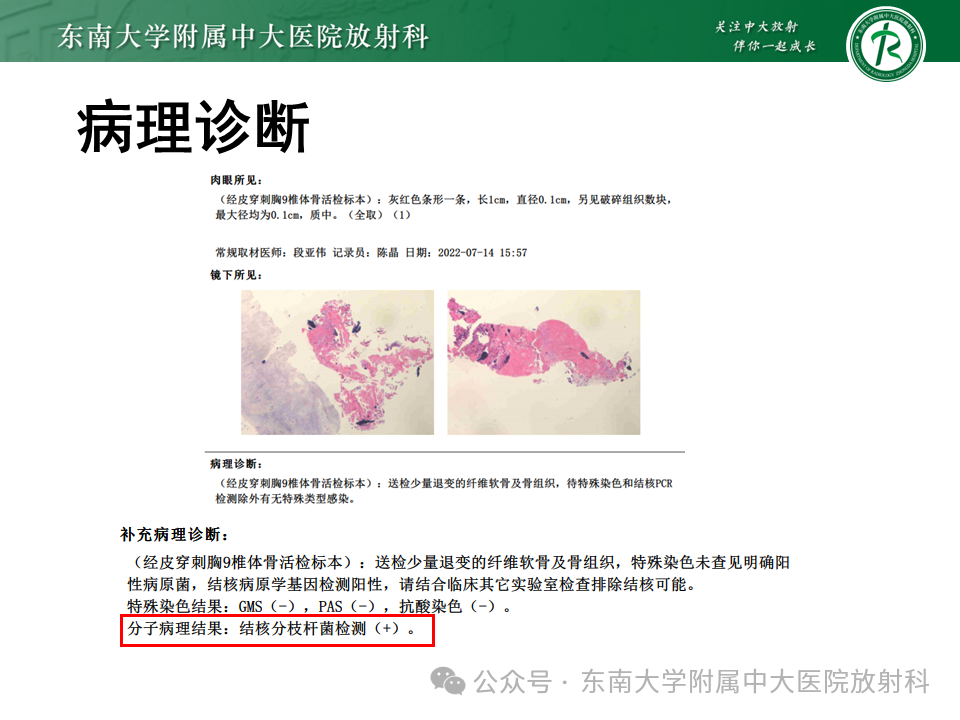 5a300b2fe8a04aa134be48cf8c4f7402.png