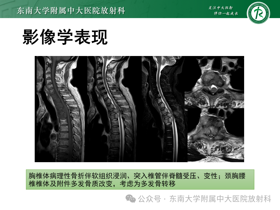 d1871cdcc5538dace04242a40340718f.png