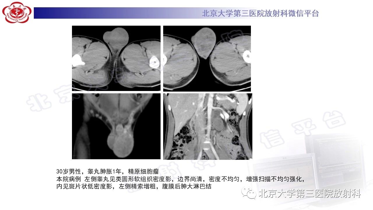 b764eba8bc09422cd7bd1e4e2d7b2929.jpg