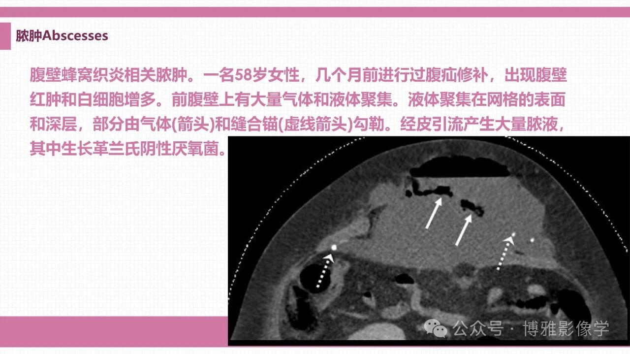 170ee33889ddce8194bc17ee196d8178.jpg