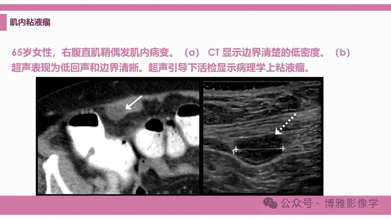 ecd6cbe8022ff1e07cb213fb2957180f.jpg