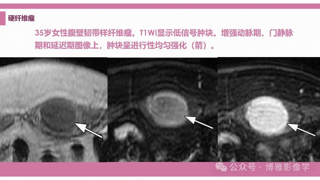 9581fa250b8bd7662cc10b539048d2bd.jpg