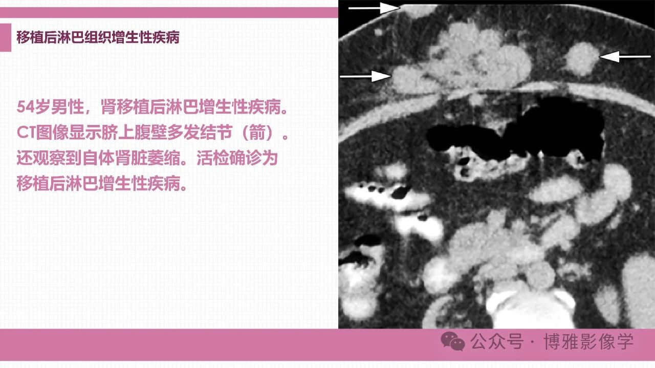 f3982cc6ccf1a5ffdff6a2eeace98701.jpg