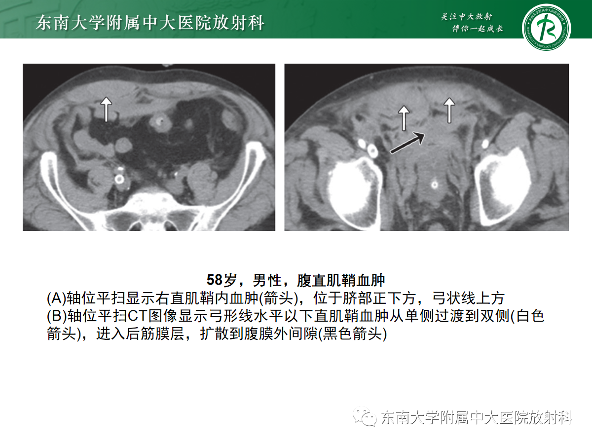 eeaa05904acdb88da73486ba910d35dc.png