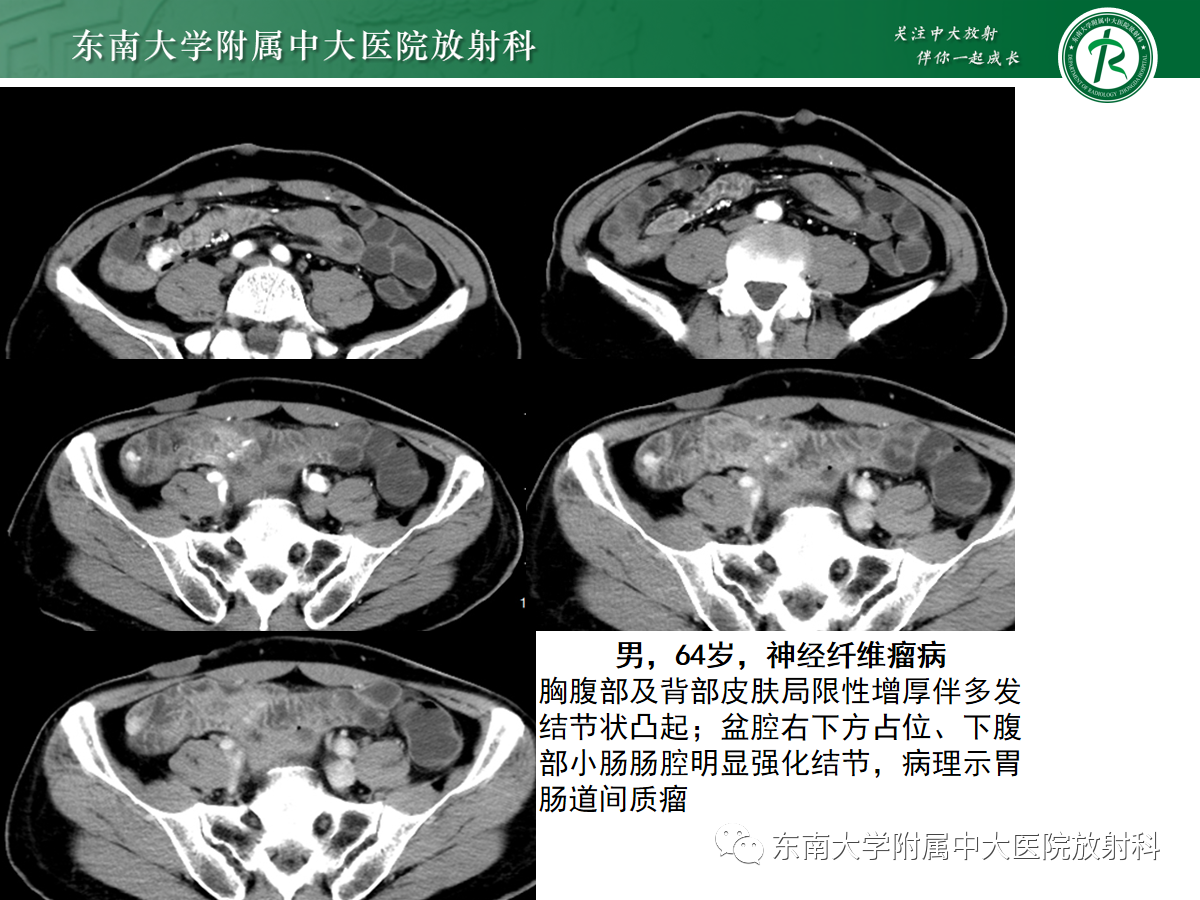 dcb10420459793d28d8b912f4b622d9e.png