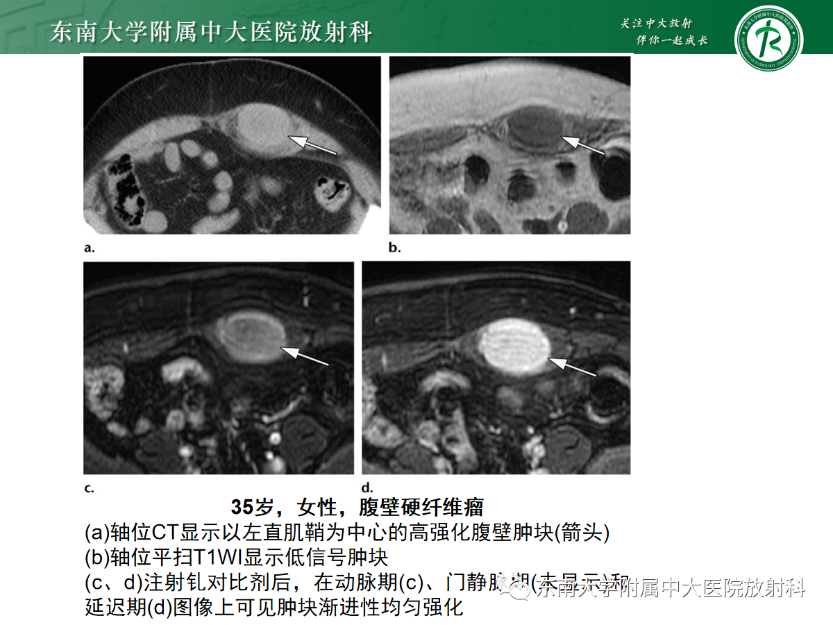 b857a5998c4f707ae43ea36631031126.png