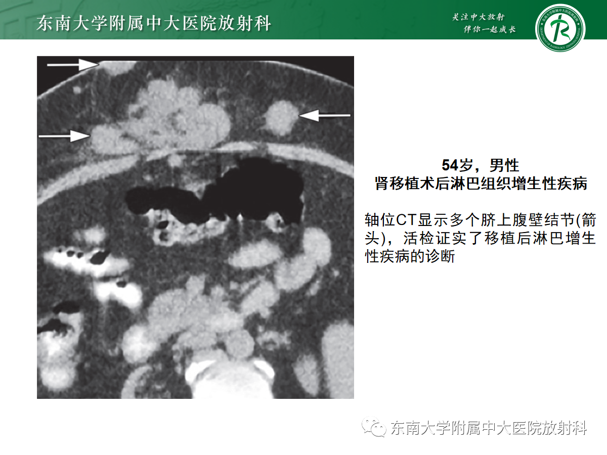 3b2819b7ca202ddc23f62d37ec116061.png