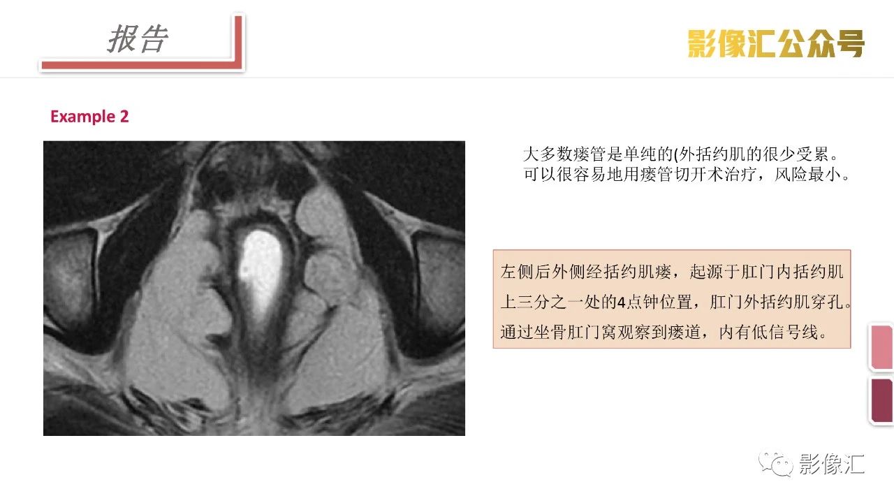b79da1fc342db523c254a672dcd59c16.jpg