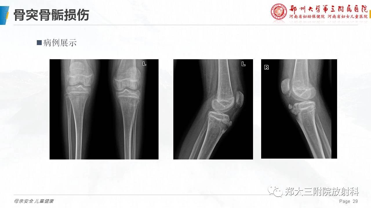 cbd88a2215fe082bbcc4284609cd6a4d.jpg