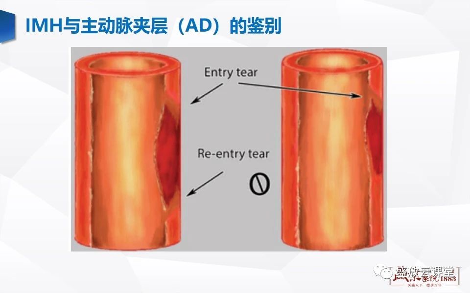 cbf7a15b4ed499b2342e40623edfe325.jpg