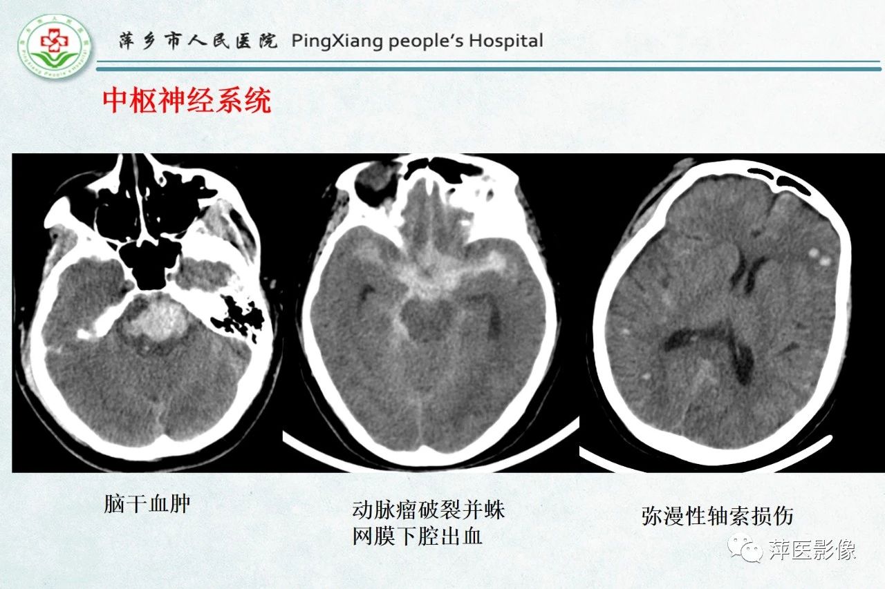 8ce6b3040beb9725026672ba58ab1e39.jpg