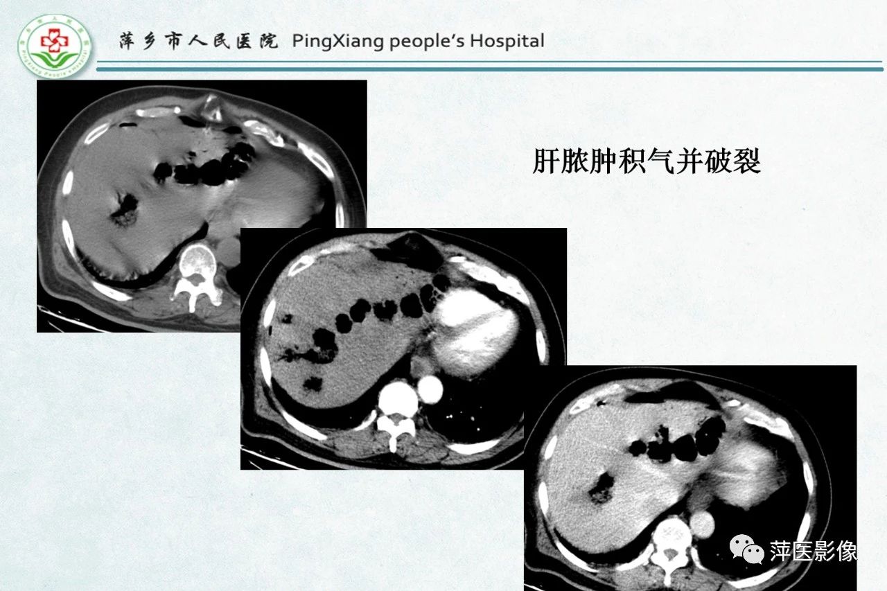 a1548ecae7f58ce41b51536db01112bd.jpg