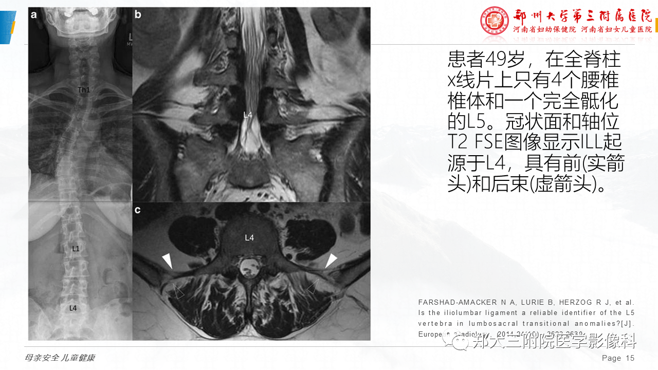 f3bd7416f24ee896fada87613cccb1c2.png