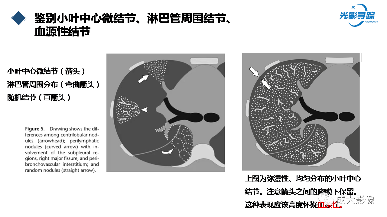 ba1a64980d0d09e5ac9618e67ecacfd7.png