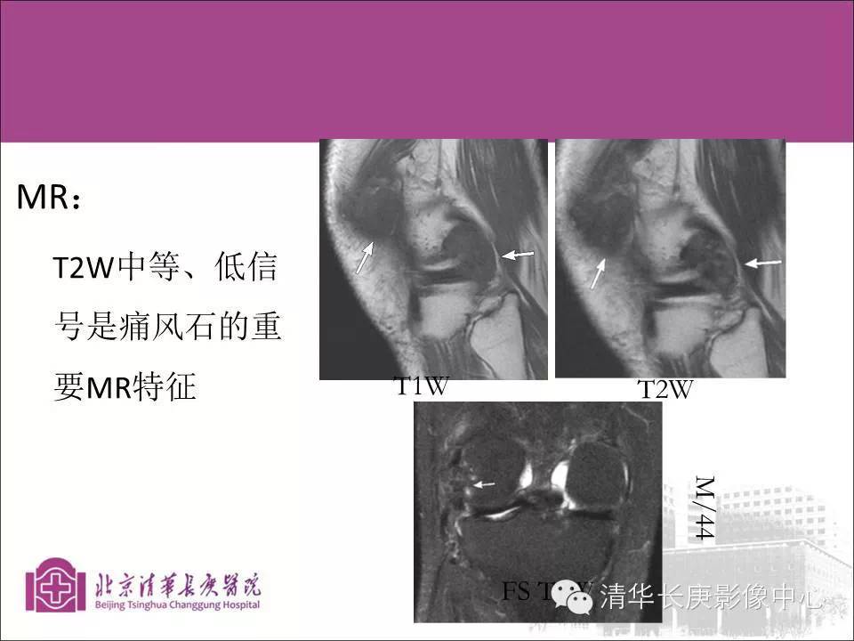 ec064d83473941b0ccb90eabedbfc95d.jpg