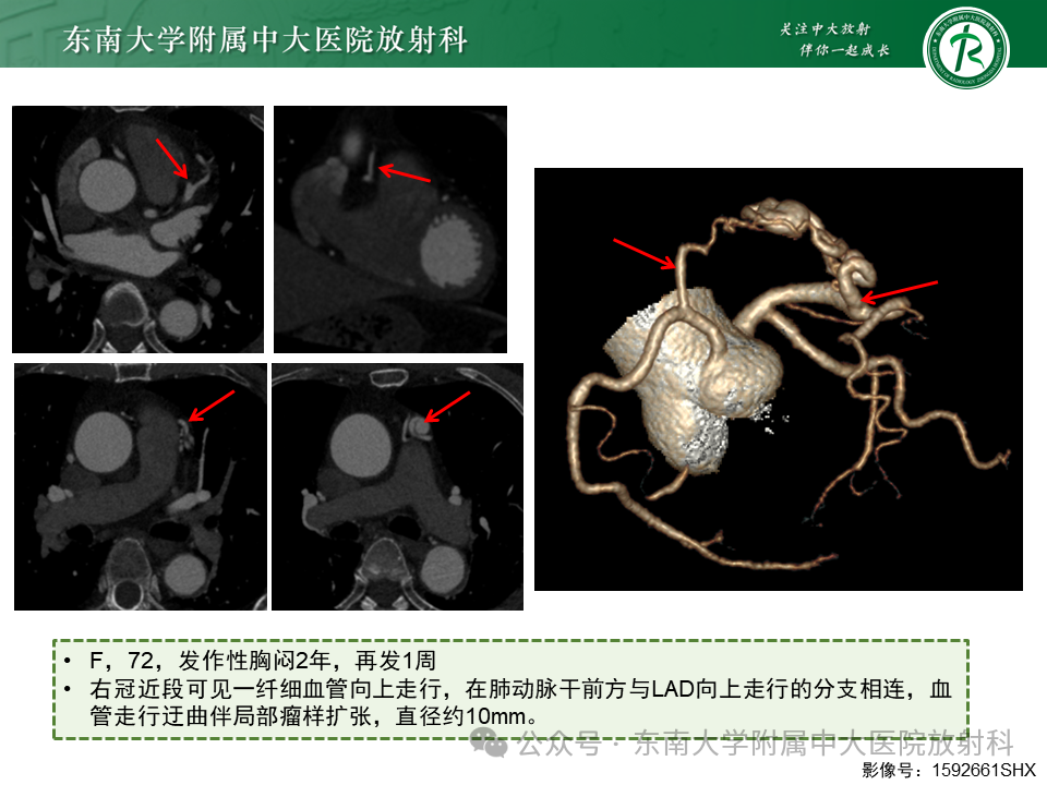 6420b29363ddcb14aa15515e591f86f3.png