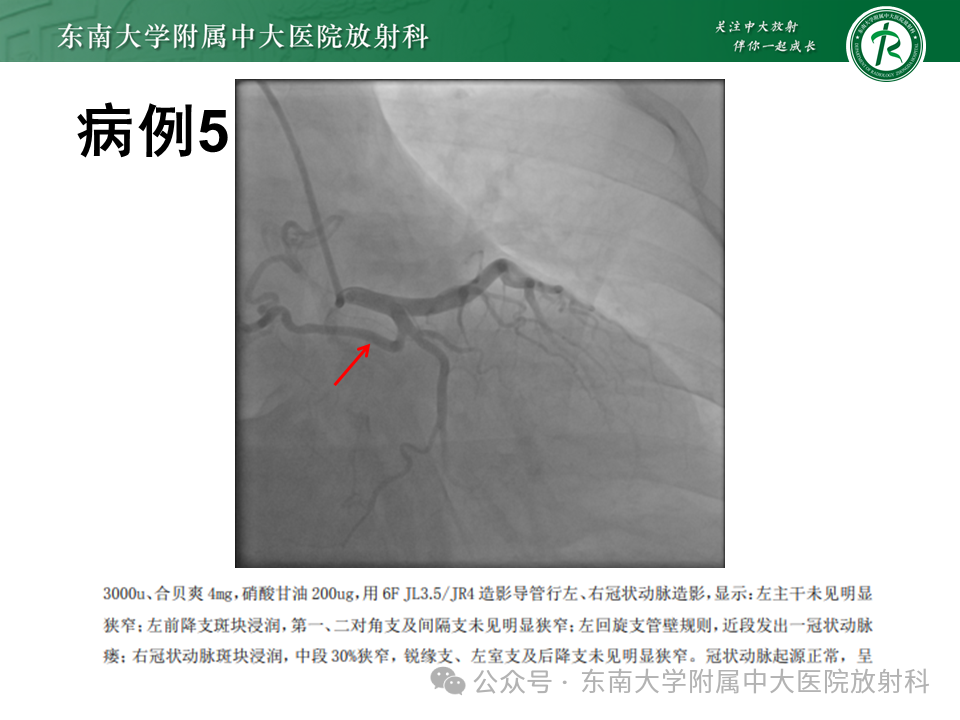 d760b17dadcb36c8e30661222c5d95ae.png