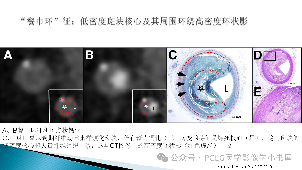 f8d627bcc2d2adeb1b7bf4b22ae8061f.png