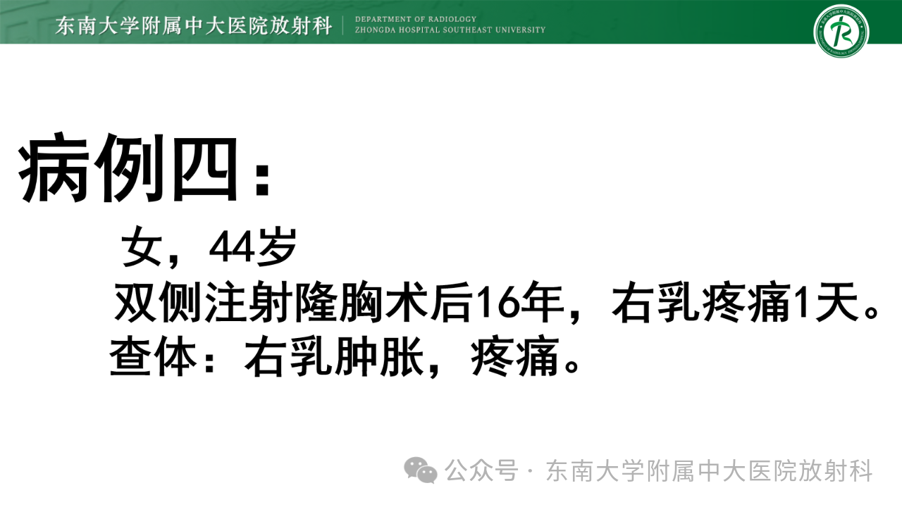 76cf044e8da1f19a87c17d778cdd62e7.png