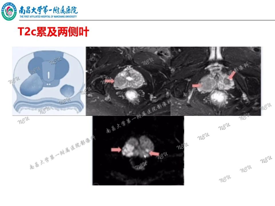 6e4d2c3330a8745b3c61c49acbb9cfd1.jpg