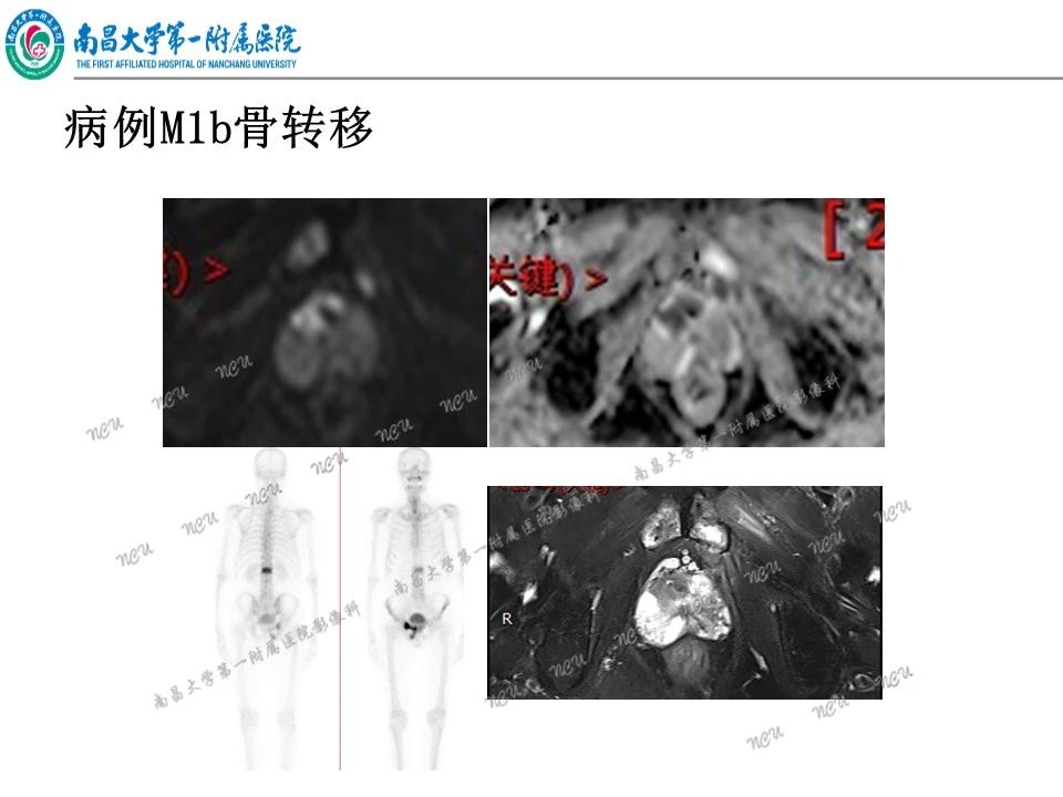 fe5ff0758b3ed35c1917775b584f439b.jpg
