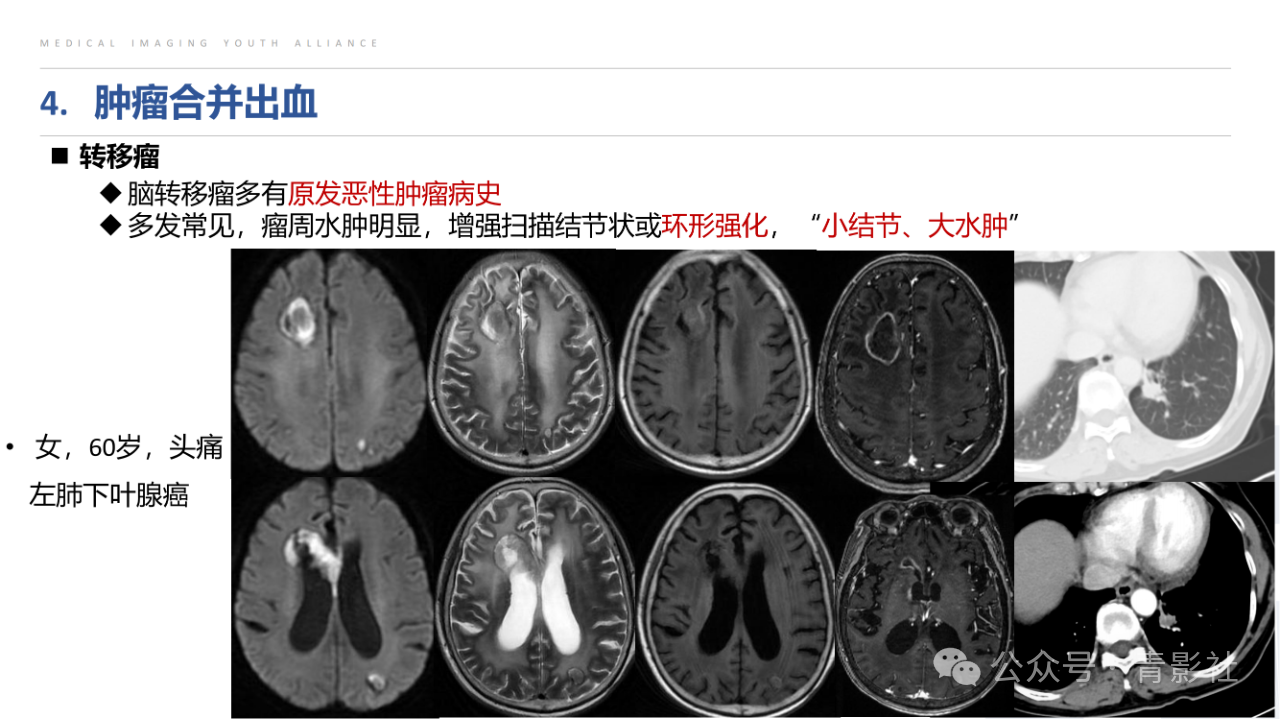 7a5a8d0c84458e6ccf1f4ec547935da4.png
