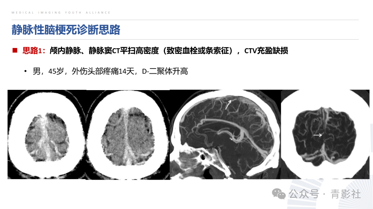 0ece53378836598fcd2044fb07a6cfbc.png