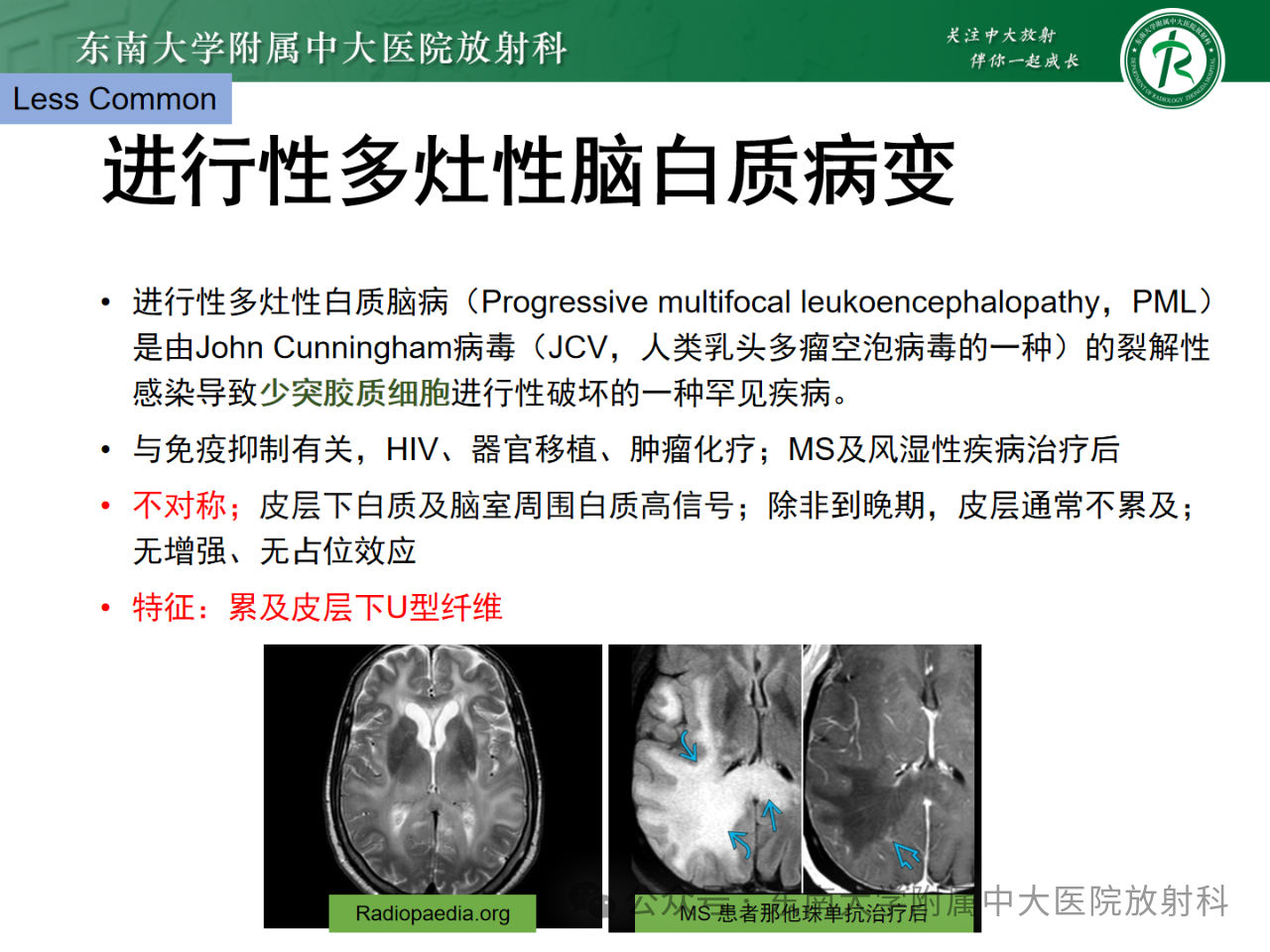 94756d8cd5e8e60a90043fb76a91c3a0.png