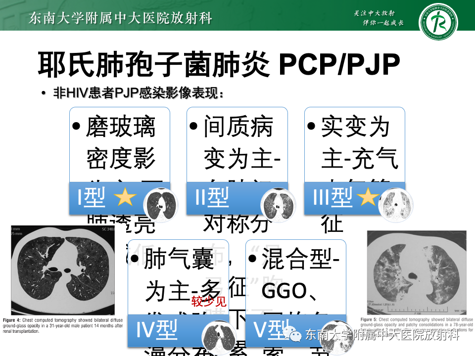 0c81f750f1f66fc9237a2519469fb131.png