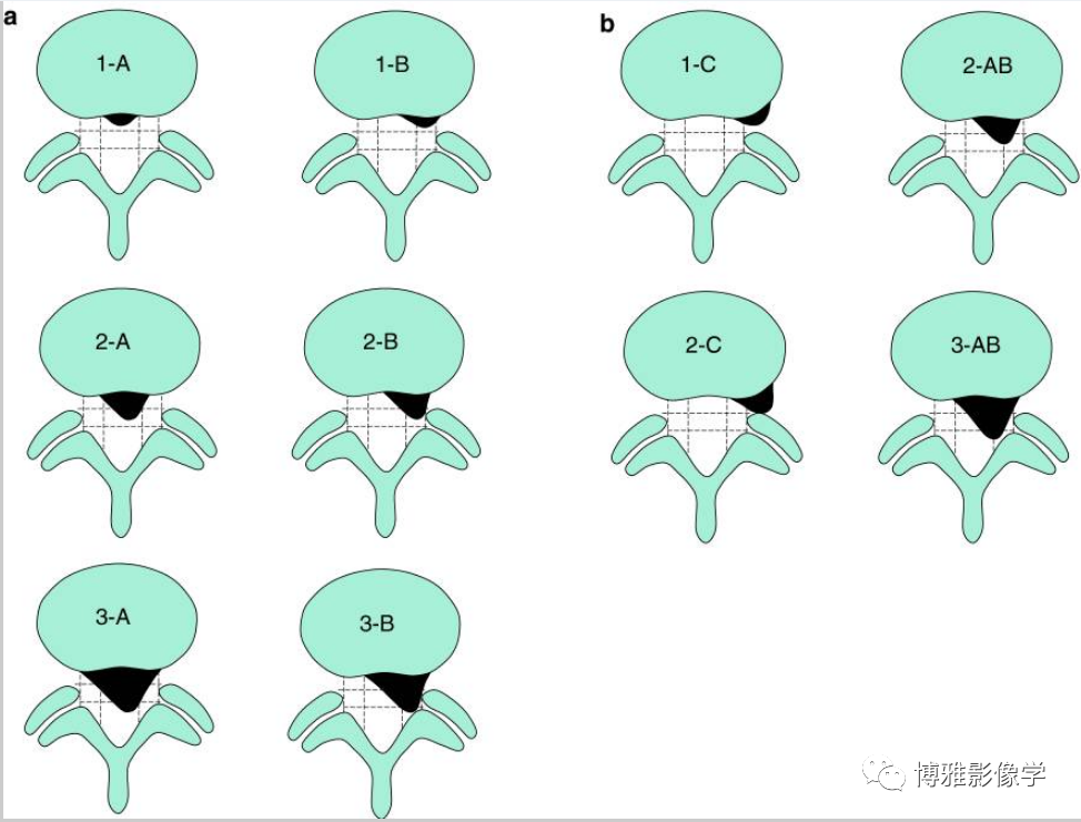847ee1568ee6a1a6b985693d808c8428.png