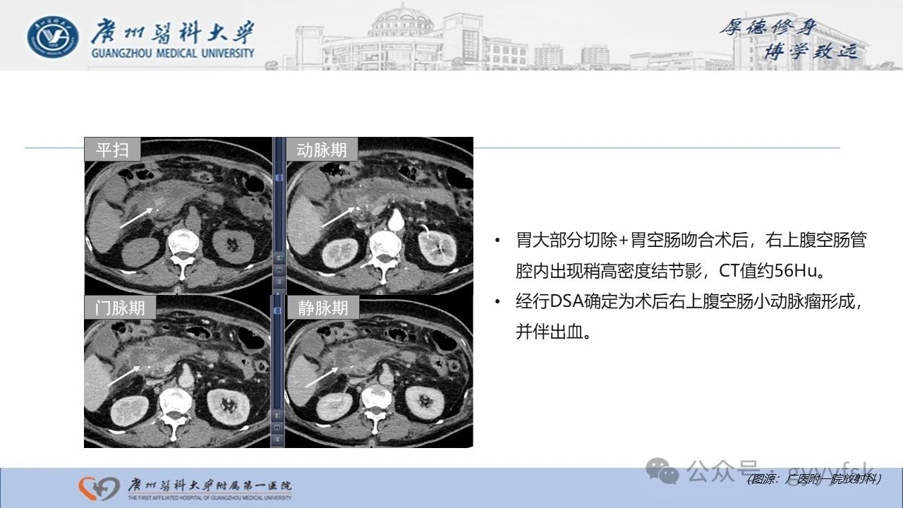 d43adadc75e7f29c4d91f8cd10124f5f.jpg