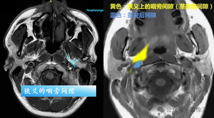 773f55bfe9633ef85b2c4da50a3a5561.png